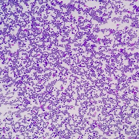 基因融合和突变的区别:基本概念、影响因素和遗传传递方式对比分析 基因融合和突变的区别:基本概念、影响因素和遗传传递方式对比分析