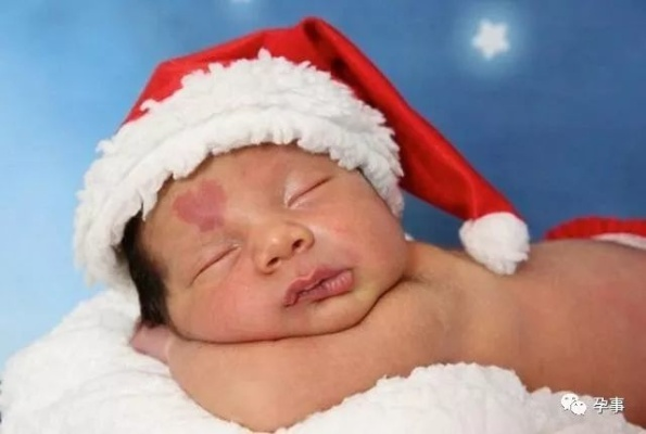 (天使之吻胎记微信群)天使之吻胎记会自然消失吗？如何有效去除这种瑕疵？