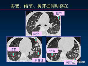 (病毒可能对社会造成哪些影响?)红蓝大作战：探讨病毒对社会的影响与挑战